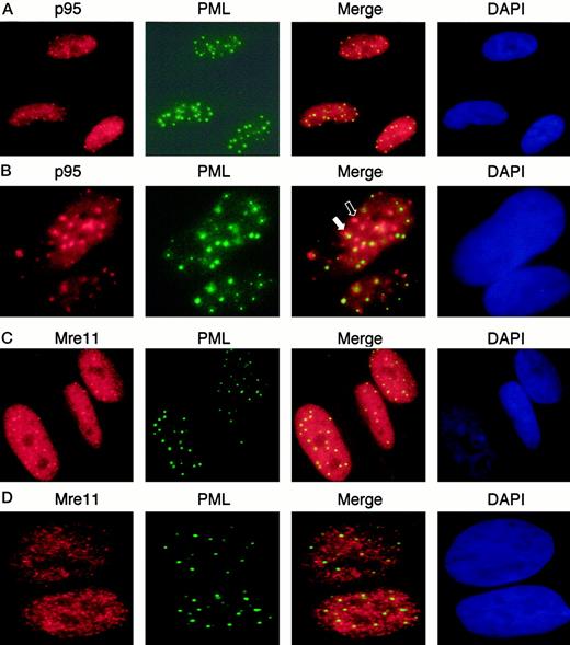 Fig. 1. Fractions of p95 and MRE11 localize to NBs. Shown are immunofluorescence images of wild-type primary human fibroblasts (WI38; A–C) or primary fibroblasts derived from an individual with NBS (GM07166; D) stained with anti-95 and anti-PML(A and B) or anti-MRE11 and anti-PML(C and D). In B, cells were irradiated with 10 Gy of IR from a 137Cs γ-source and then allowed to recover for 8 h prior to fixation and staining. Extensive colocalization of focal p95 and NB staining are observed in WI38 cells (A). After γ-irradiation, p95 appears in foci adjacent to some NBs (B, closed arrow) and also appears at additional foci not associated with NBs (B, open arrow). MRE11 is also present at NBS (C) in a p95-dependent manner(D).