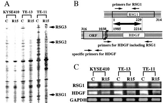 Fig. 1. A, differential displays of three esophageal cancer cell lines. These displays were carried out using an anchor primer gT15G (5′-GTTTTTTTTTTTTTTTG-3′) and AP-9 (arbitrary primer; 5′-CAGTGTGCTC-3′). Arrows, differentially expressed genes (RSG1, RSG2, and RSG3). C, the control parent cell line; R15, the radioresistant cell line after 15 treatments of 2 Gy of irradiation (total, 30 Gy). B, identity between RSG1 and HDGF, and primer positions. Nucleotide sequence 1–229 of RSG1 was completely homologous to 1985–2214 of HDGF. Oligonucleotide primer pairs were as follows: for RSG1, sense, 5′-CTTCTATTTGGGGCTTGATGAC-3′, and antisense, 5′-GCACTTATTTCTCTCGGTCCTC-3′); and for HDGF containing the RSG1 sequence, sense, 5′-CTGAAGCCACAAATAGGATG-3′, and antisense, 5′-GGGTAAAAGAGACGAGACTG-3′. Specific primers for HDGF were designed in the open reading frame (sense, 5′-CCGCCATGTCGCGATCCAACC-3′; antisense, 5′-ACATTGGTGGCTACAGGCTCT-3′). C, semiquantitative RT-PCR assay for RSG1 and HDGF, which includes the RSG1 sequence by using primer pairs shown in Fig. 1B<$REFLINK>. Note the suppressed expression of both RSG1 and HDGF in radioresistant cell lines.