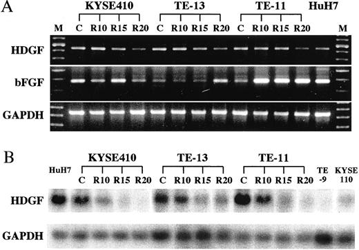 Fig. 2. A, the expression of HDGF and bFGF mRNA by using specific primers. The HDGF expression was reduced along with repetitive treatments of 2 Gy of irradiation in all three cell lines, but there was no relation between bFGF expression and repetitive treatments. Oligonucleotide primer pairs for bFGF were: sense, 5′-AAAACGGGGGCTTCTTCCTG-3′; and antisense, 5′-CGTTTCAGTGCCACATACCAA-3′. C, the control parent cell line. R10, R15, and R20, the radioresistant cell line with 10, 15, and 20 treatments of 2 Gy of irradiation. M, marker. HuH7, human hepatoma cell line. B, Northern blot analysis confirmed the relation between HDGF mRNA expression and radiosensitivity. Two untreated cell lines, TE-9 and KYSE110, expressed no or a very little HDGF mRNA.