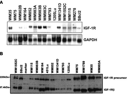 Fig. 1. IGF-1R expression in human melanoma cells. A, Northern analysis of total RNA from 15 melanoma cell lines. Fifteen μg of RNA were separated by formaldehyde-agarose gel electrophoresis and hybridized to a full-length IGF-1R cDNA probe (top gel). The same blot was then hybridized to housekeeping glyceraldehyde-3-phosphate dehydrogenase (GAPDH; bottom gel). B, Western analysis of extracts of melanoma cells for IGF-1R. The protein extracts were separated by SDS-PAGE and analyzed for IGF-1R, using rabbit polyclonal antibodies against the β subunit followed by electrochemiluminescence for detection.
