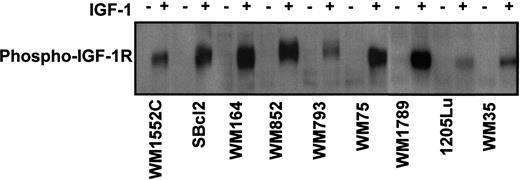 Fig. 4. Phosphorylation of IGF-1R in human melanoma cells. Melanoma cell lines in protein-free medium were incubated with recombinant IGF-1 for 10 min, and the cell extracts were then immunoprecipitated with anti-IGF-1R antibodies against the β subunit. The immunoprecipitated proteins were separated by SDS-PAGE and hybridized against antiphosphotyrosine antibodies. The phosphorylated proteins were detected by electrochemiluminescence.