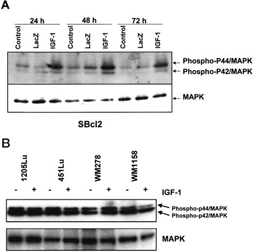 Fig. 5. Activation of MAP kinase (MAPK) in melanoma cells by IGF-1. Protein extracts of melanoma cells transduced with IGF-1 or lacZ were separated on SDS-polyacrylamide gels and hybridized to phospho- and native-specific MAP kinase antibodies. A, detection of MAP kinase in RGP SBcl2 melanoma cells 24, 48, and 72 h after transduction. B, constitutive activation of MAP kinase in advanced VGP primary and metastatic melanoma cell lines. Melanoma cells were transduced with either IGF-1 or lacZ and analyzed 48 h later for MAP kinase activity, using antibodies against phospho- and native-specific proteins.