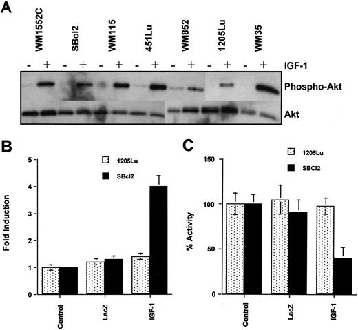 Fig. 6. IGF-1-induced alterations in Akt and GSK-3β activities in melanoma cells. A, induction of Akt phosphorylation by IGF-1. The cell lines were incubated in the presence (+) or absence (−) of recombinant IGF-1 for 20 min. Cell extracts were analyzed for phosphorylation of Akt by a phosphospecific antibody (top bands). Constitutive levels of Akt are indicated by the bottom bands. B, melanoma cells were transduced with IGF-1 and then incubated in protein-free medium for 48 h, at which time cells were harvested and analyzed for PKB/Akt activity, using histone H1B. Proteins were separated by SDS-PAGE, and the phosphorylated bands were detected by autoradiography. C, IGF-1- or lacZ-transduced melanoma cells were analyzed for GSK-3β activity with Tau as substrate, using the same procedure as for histone H1B. Bars, SD.