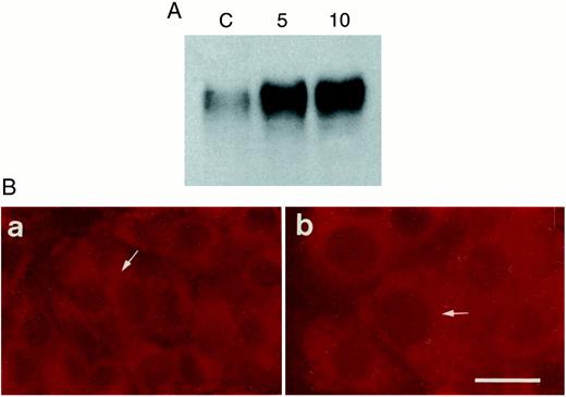 Fig. 5. Radiation induces increase in LAMP-1 levels. A, Western blotting analysis of LAMP-1. Cells were harvested 48 h after irradiation with 10 Gy. Equal amounts of cell lysates from control and irradiated cells were analyzed for LAMP-1 content. C, control unirradiated cells. 5, cells irradiated with 5 Gy. 10, Cells irradiated with 10 Gy. B,immunolocalization of LAMP-1 in control and irradiated cells. The staining showed the increased levels of LAMP-1 in the cells at 48 h after irradiation and its localization to vesicular bodies. a, unirradiated cells. b, cells irradiated with 10 Gy.