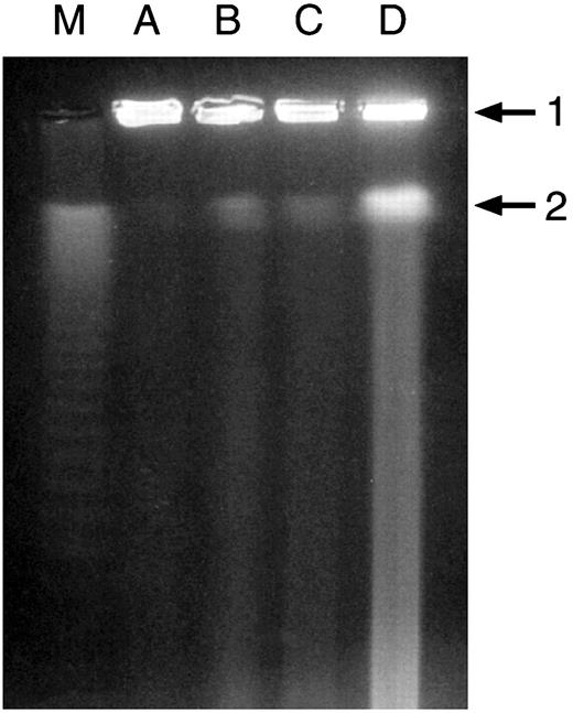 Fig. 6. Bafilomycin A1 enhances DNA fragmentation in irradiated cells. Cells were irradiated 48 h post-plating, and bafilomycin A1(4 nm) was added 48 h after irradiation, for the duration of 24 h, from concentrated stock solution in DMSO to a final concentration of 4 nm. Control cells received the vehicle alone. Cells were harvested 72 h after irradiation. Plug preparation and resolution of DNA was conducted according to Gilles et al. (19) M, DNA size standard, lambda ladder (50 kb). A,unirradiated controls. B, cells irradiated with 10 Gy. C, unirradiated cells incubated with 4 nmbafilomycin A1. D, cells irradiated with 10 Gy and incubated with 4 nm bafilomycin A1. Window of DNA resolution was 20 kb–1000 kb. Arrow 1 points to sample origin. Arrow 2 points to zone of no resolution.