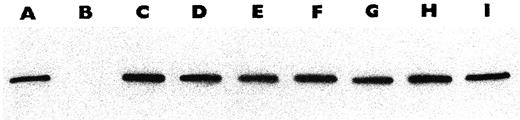 Fig. 6. Immunoblot analyses of CHO/AA8, CHO/MCRA, and cell lines derived from CHO/MCRA. Samples were separated by PAGE and transferred to a nitrocellulose filter. The equivalent of 1 × 105 cells was loaded per lane. The filter was reacted with anti-MCRA antibody (1:10,000 dilution), and bands were visualized using the ECL method described in “Materials and Methods.” Lane designations are as follows: Lane A, CHO/MCRA; Lane B, CHO/AA8; Lane C, CHO/MCRA-DTD-13; Lane D, CHO/MCRA-DTD-210; Lane E, CHO/MCRA-DTD-6; Lane F, CHO/MCRA-DTD-41; Lane G, CHO/MCRA-FpT-5a; Lane H, CHO/MCRA- FpT-5b; Lane I, CHO/MCRA-vector-7.