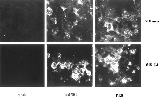 Fig. 2. NP-specific immunofluorescence of 518-neo and 518-L1 cells after viral infection. Cells were infected at a m.o.i. of 3. Immunostaining was done 10 h after infection. The cell line is indicated to the right. Viruses used are indicated at the bottom.