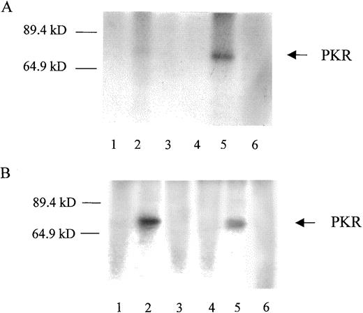 Fig. 4. A, immunoprecipitation of activated PKR of 518-neo cells and 518-L1 cells after viral infection. Cells were infected at an m.o.i. of 3. Immunoprecipitation was done after infected cell lysates were labeled with 32P for 2 h at 5 h postinfection. Bands were separated on a 10% SDS gel. The experiment was repeated and gave similar results. Autoradiographs of one experiment are shown. Lanes 1–3, 518-L1 cells; Lanes 4–6, 518-neo cells; Lanes 1 and 4, mock-treated; Lanes 2 and 5, delNS1 virus; Lanes 3 and 6, PR8 virus. B, immunoprecipitation of activated PKR of 518-neo cells after viral infection. Cells were grown in the absence (Lanes 1–3) and presence (Lanes 4–6) of 2-AP. Lanes 1 and 4, mock-treated; Lanes 2 and 5, delNS1 virus; Lanes 3 and 6, PR8 virus. Size marker is indicated on the left.