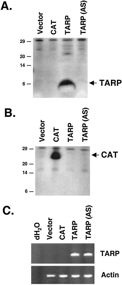 Fig. 1. Characterization of the PC3 stable cell lines. A, Western blot of nuclear extracts derived from each respective PC3 stable cell line. Forty μg of nuclear extract were run on a Tris/Tricine 16.5% polyacrylamide gel and probed with an antibody against TARP. Size markers in kDa are indicated on the left. An arrow on the right indicates TARP. B, Western blot of whole cell extracts derived from each respective PC3 stable cell line. Forty μg of protein extract were run on a Tris/Tricine 16.5% polyacrylamide gel and probed with an antibody against CAT. Size markers in kDa are indicated on the left. An arrow on the right indicates CAT. C, RT-PCR analysis of TARP mRNA expression. PCRs with primers that will recognize TARP expression in the sense and antisense directions (top) or actin primers (bottom) were performed with cDNAs derived from each respective PC3 stable cell line. RT-PCRs performed without templates are indicated as dH2O. PCR products (20%) were run on a 1% agarose gel and visualized by ethidium bromide staining.