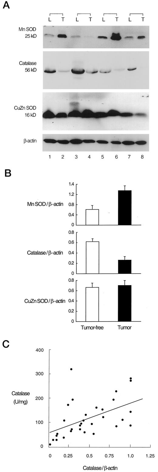 Differential Expression of Manganese Superoxide Dismutase and Catalase