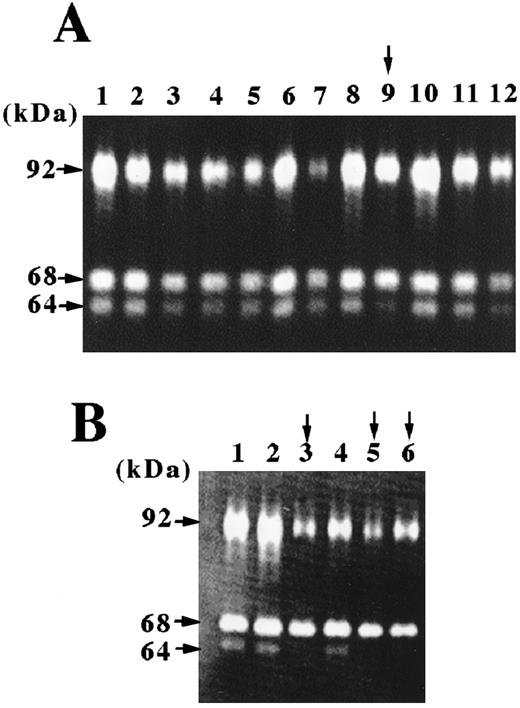 Fig. 1. Expression cloning. A, plasmid DNA from the human fetal kidney cDNA library was cotransfected with MMP-9, MMP-2, and MT1-MMP into 293T cells cultured in 96-well microplates as described in “Materials and Methods,” and cell lysates were subjected to gelatin zymography at 48 h after transfection. Note that processing of pro-MMP-2 to the active form was inhibited in Lane 9 in the first screening. B, in the second screening, single clones of plasmid DNA were extracted and analyzed as described above. Note that pro-MMP-2 processing was inhibited in Lanes 3, 5, and 6.