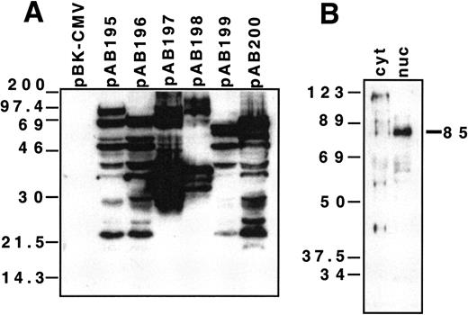 Fig. 1. Western blotting of recombinant proteins and cell lysates with monoclonal antibody JC12. A, antibody JC12 reactivity with recombinant proteins expressed from each of the isolated cDNA clones. There is no reactivity with the pBK-CMV empty vector. In B, the antibody detects an Mr 85,000 protein in nuclear (nuc) tonsillar extracts.