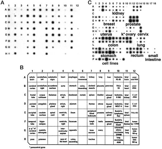 Fig. 3. Analysis of the expression of the FOXP1 mRNA in human tissues. A, hybridization of the FOXP1 cDNA to a MTE array. B, legend to the MTE array. C, hybridization of the FOXP1 cDNA to a matched tumor/normal expression array. Tissue sources for cDNAs on the array are as follows: normals row A/tumors row B, kidney 1–14; normals row D/tumors row E, breast 1–9, prostate 11–13; normals row G/tumors row H, uterus 1–7, k∗ kidney 8, ovary 10–12, cervi × 14; normals row J/tumors row K, colon 1–11, lung 13–15; normals row M/tumors row N, stomach 1–8, rectum 10–16, small intestine 18. Row P human cancer cell lines: 1 HeLa, 2 Daudi, 3 K562, 4 HL-60, 5 G361, 6 A549, 7 MOLT-4, 8 SW480, and 9 Raji.