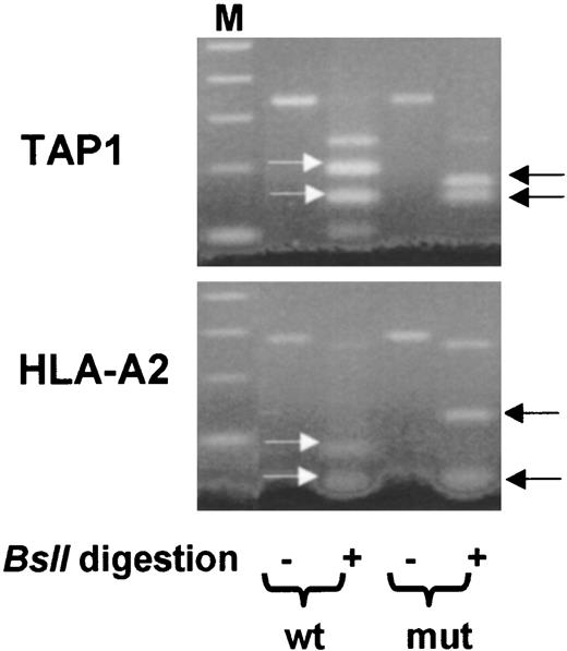 Fig. 1. Genomic PCR of mutant (mut) and wt TAP1. a, amplification products obtained by genomic PCR from the wt and mut Tap1 gene were tested for the presence of the distinct BslI cleavage pattern generating in the mutated Tap1 three fragments and two fragments in the wt Tap1 gene. Lane 1, 100-bp molecular weight marker; Lane 2, uncut PCR product from wt Tap1 (326 bp, cell line MZ1257); Lane 3, BslI-digested PCR products of wt Tap1 (sizes 137 and 191 bp); Lane 4, uncut PCR product from mut Tap1 (326 bp, cell line buf 1280); Lane 5, BslI-digested PCR products of mut Tap1 [sizes 22 (not visible) 68 and 137 bp]. b, amplification products of the HLA-A2 gene were tested for the presence of the different BslI digestion profile, resulting in six fragments of the mutated HLA-A2 and eight of the wt HLA-A2 gene. Lane 1, 100-bp molecular weight marker; Lane 2, uncut PCR product from wt HLA-A2 (391 bp, cell line MZ1257); Lane 3, BslI-digested PCR products of wt HLA-A2 [sizes 7, 22, 30, (not visible) 44, 48, 51, 89, and 90 bp]; Lane 4, uncut PCR product from mut HLA-A2 (391 bp, cell line buf1280); Lane 5, BslI-digested PCR products of mut HLA-A2 [sizes 7, 22, 30 (not visible), 48, 51 and 138 bp].