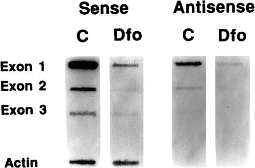 Fig. 5. Effect of DFO on N-myc transcription. Nuclei were harvested for nuclear run-on assay after 24 h culture in RPMI 1640 + 10% FBS with either 50 μm DFO or water. N-myc target sequences were exon 1, exon 2, or exon 3 of N-myc as designated, cloned into M13 mp 10 or mp 11 in each orientation to yield single-stranded targets for detection of either sense or antisense transcription. Double-stranded probes for human β-actin were used to normalize for extent of hybridization.