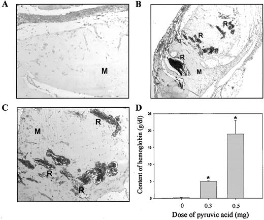 Fig. 2. Angiogenesis induced by pyruvic acid in in vivo mouse Matrigel-plus assay. The experimental procedures are described under “Materials and Methods.” A, the Matrigel without pyruvic acid did not show any migration or invasion of endothelial cells. However, with Matrigel containing pyruvic acid (0.3 mg), many blood vessels appeared in the gel (B, ×40; C, ×100). Arrows, the functional neovessels containing RBCs. D, quantitation of active vasculature inside the Matrigel by measurement of hemoglobin content. Each value represents the mean of at least four animals, and similar results were obtained in two different experiments; bars, ± SE. M, Matrigel; R, RBCs. ∗, P < 0.05 versus hemoglobin content of control.
