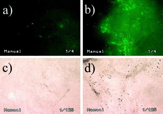 Fig. 1. In vivo expression of reporter genes in B16.F10 melanoma 48 h after injection of 50 μg of EGFP or β-gal plasmid (in 50 μl of PBS) into tumors (at 5–7 mm in diameter or 65–179 mm3 in volume) with or without consecutive electroporation. Photomicrographs (×500) of: a, EGFP plasmid injection without electroporation; b, EGFP plasmid injection with electroporation; c, β-gal plasmid injection without electroporation; and d, β-gal plasmid injection with electroporation. Sections were carried out at 250 μm using fresh tumor tissues that had not been fixed or frozen. In each group of experiments, five to seven animals were used.