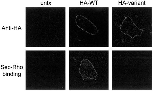 Fig. 3. Expression of wild-type and variant secretin receptors in Panc-1 cells. HA-tagged wild-type and variant secretin receptor constructs were transfected into Panc-1 cells using lipofectin. Seventy-two h after transfection, the cells were immunostained with anti-HA antibody and examined by confocal microscopy (top row images). Surface staining was observed for each of the transfected cells but not in controls. Aliquots of the same cells were also incubated with a well-characterized fluorescent secretin analogue (50 nm) at 4°C for 1 h, washed with PBS, fixed, and examined by confocal microscopy (bottom row images). Ligand binding was observed only in cells expressing wild-type secretin receptor.