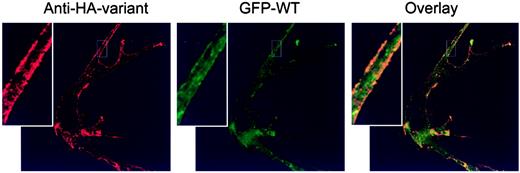 Fig. 5. Colocalization of wild-type and variant secretin receptors on cell surfaces. COS cells were cotransfected with HA-tagged variant secretin receptor and GFP-fused wild-type secretin receptor constructs (2 μg of each). The cells were fixed 72 h after transfection, at which time they were examined by confocal microscopy. In the left panel is shown a typical cell immunostained with anti-HA antibody. In the middle panel, the GFP fluorescence from the same cell is shown. In the right panel is shown the composite of both fluorophores. Also shown are enlarged views of the same portion of this cell in each panel.