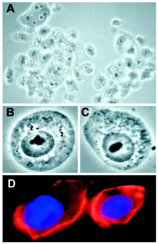 Fig. 2. Single-cell suspension obtained from MDA-MB 435 breast cancer cells grown in nude mice. The mice were sacrificed and perfused, and the tumor was snap-frozen in isopentane. The tumor was thawed and squeezed through a cell strainer. A–C, the cells fresh from the preparation in phase contrast (A, ×200; B and C, ×630). D, the cells from the same cell preparation stained with DAPI for DNA and cell-membrane labeling with 50 μg/ml wheat-germ agglutinin coupled with biotin (Pierce) for 30 min. Detection was performed with 5 μg/ml Streptavidin-PE (PharMingen).