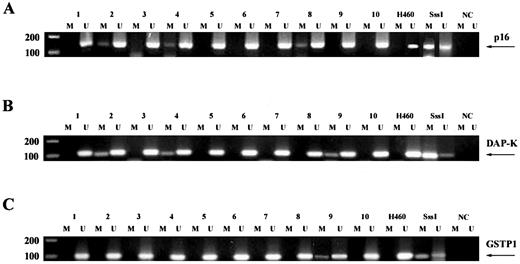 Fig. 1. Methylation analysis of three genes in bronchial brush samples from former cigarette smokers. At the right of each panel, the gene studied. Lanes 1–10, samples from different former smokers. H460, NSCLC cell line NCI-H460. SssI, NCI-H460 DNA treated by SssI methylase (positive control). NC, negative control; Lanes M, amplified product with primers recognizing methylated sequence; Lanes U, amplified product with primers recognizing unmethylated sequence.