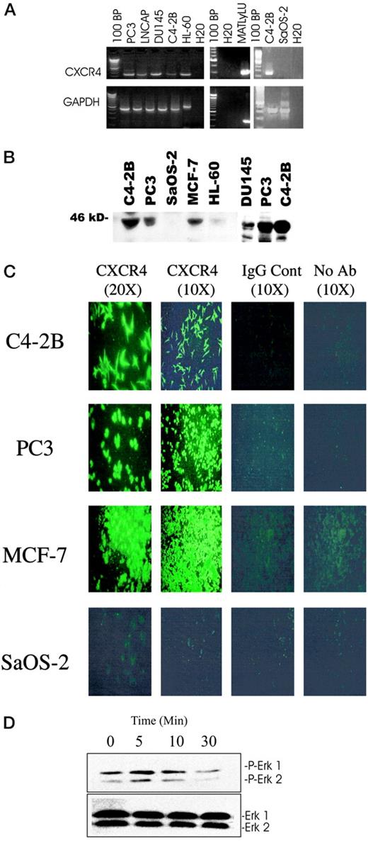 Fig. 2. Functional CXCR4 receptors are expressed by prostate cancer cell lines. In A, ethidium bromide-stained gel of RT-PCR performed using RNA recovered from human (DU145, PC3, LNCAP, and C4-2B) and rat (MatLyLu) prostate cancers, with SaOS-2 and HL-60 cells, as negative and positive controls, respectively. CXCR4 mRNA was observed for all cell types evaluated except SaOS-2. B, Western blot probed directly with a monoclonal anti-CXCR4 (B, right) or a polyclonal antibody (B, left), demonstrating a Mr 46,000 band corresponding to the CXCR4 receptor. Controls included protein isolated from MCF-7, HL-60 (positive), and SaOS-2 cells (negative) cells. C, immunohistochemistry with an isotype-matched control or CXCR4 antibody demonstrating CXCR4 expression by C4–2B, PC3, and MCF-7 (positive control) but not SaOS-2 (negative control). D, Western blots of SDF-1-stimulated PC-3 cells using antibodies that detect total (bottom) and phosphorylated (P) Erk-1 and Erk-2 proteins (top). The data demonstrate that SDF-1 stimulates phosphorylation of ERK proteins in PC3 cells.