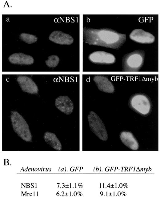 Fig. 4. NBS1 and Mre11 associate with APBs in the presence of overexpressed GFP-TRF1Δmyb. A, actively growing GM847 cells were infected with high-titer adenovirus bearing a GFP or GFP-TRF1Δmyb translational fusion, which act as a dominant negative. Cells were harvested at 36 h after infection and stained against NBS1 (a and c). b and d show the fluorescent signal of GFP alone (the control) or GFP-TRF1Δmyb in the same field of cells as in a and c, respectively. Note that some cells overexpressing GFP or GFP-TRF1Δmyb form APB-characteristic NBS1 foci. B, fractions of GM847 cells containing APB-characteristic NBS1 or Mre11 foci in cells infected with indicated adenoviruses as described in (A). Cells containing more than five APB-characteristic foci for NBS1 or Me11 were counted, and the percentage (versus the total population) is presented. For each experiment, at least 220 cells in total were evaluated, and the results are summarized from two independent experiments.
