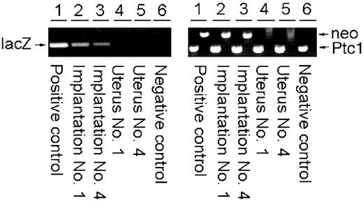 Fig. 4. PCR confirmation of the presence of lacZ and neo genes in postimplantation embryos derived from transplanted medulloblastoma nuclei. Lane 1, positive control; Lane 6, negative control. Lanes 2 and 3 contain DNA extracted from implantations No. 1 (E8.5-day embryo derived from SJMM2) and No. 4 (E6.5-day embryo derived from SJMM4), respectively. Lanes 4 and 5 contain DNA extracted from maternal uterine tissues from recipients for implantations No. 1 and No. 4, respectively. Arrows, the positions of authentic lacZ, neo, and Ptc1 amplicons. The endogenous Ptc1 allele serves as DNA loading control.