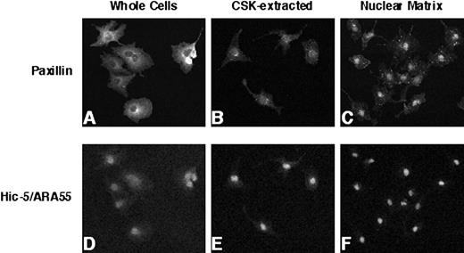 Fig. 1. IIF analysis of endogenous paxillin and Hic-5/ARA55 localization in CV-1 cells. CV-1 cells were fixed with paraformaldehyde and processed for IIF analysis using either an anti-paxillin antibody (A–C) or anti-Hic-5/ARA55 antibody (D–F). Before fixation, cells were either permeabilized with low-salt detergent buffer (CSK-extracted; B and E) or further digested with DNase I and then extracted with ammonium sulfate to generate a nuclear matrix fraction (C and F).