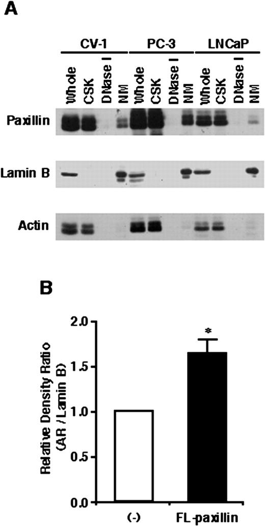 Fig. 2. Subcellular localization of paxillin and effects on AR nuclear matrix binding. A, proteins present in whole-cell lysates (Whole), CSK buffer-extracted supernatants (CSK), DNase I-digested supernatants (DNase I), or nuclear matrix pellets (NM) from CV-1, PC-3, and LNCaP cells were separated by SDS-PAGE and subjected to Western blot analysis using an anti-paxillin antibody. Blots were also stripped and reprobed with an anti-lamin B or anti-actin antibody. B, CV-1 cells transiently transfected with an AR and paxillin expression vector were incubated with 100 nm DHT for 2 h. Nuclear matrix fractions from transfected cells were subjected to Western blot analysis using an anti-AR and anti-lamin B antibody. AR in the nuclear matrix fraction was normalized using lamin B. ∗, P < 0.05, significantly different from the mean value of paxillin-nontransfected control; bars, SE.
