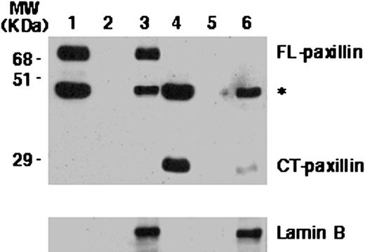 Fig. 3. Subcellular localization of FL COOH-terminal truncated paxillin in CV-1 cells. CV-1 cells were transiently transfected with expression plasmids for either FL HA-tagged paxillin (Lanes 1–3) or a deletion derivative of paxillin containing its COOH-terminal (CT) LIM domains (Lanes 4–6) and subjected to subcellular fractionation. The CSK buffer-extracted fraction (Lanes 1 and 4), DNase I-digested fraction (Lanes 2 and 5), and the nuclear matrix fraction (Lanes 3 and 6) prepared from transfected cells were subjected to Western blot analysis with anti-HA antibody and reprobed with anti-lamin B antibody. ∗, nonspecific band that appeared upon anti-HA antibody staining of blot.