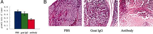 Fig. 4. Growth inhibition of HeLa MR in nude mice treated with antihuman IgG. A, after tumor formation, antihuman IgG was injected intratumorally once every 3 days in 13 mice. Injection of normal goat IgG (n = 8) and PBS (n = 13) served as controls. B, on day 21 after treatment, the mice were sacrificed, and the tumors observed histologically (H&E staining).