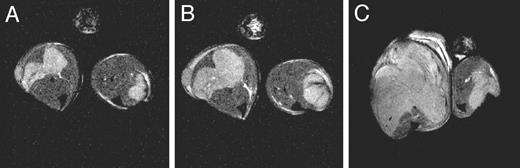 Fig. 7. Imaging of antitumor effects of serial OT-I CD8+ T cell injections. Axial slices of serial MR images of mice carrying B16F0 (left) and B16-OVA (right) at A, 12 h after initial adoptive transfer of 107 OT-I CD8+ T cells; B, 12 h after second adoptive transfer; and C, 72 h after third adoptive transfer (7 days after initial administration). Both B16F0 and B16-OVA tumors continue to grow at equal rates up until 60 h (B, 12 h after second dose), but by 7 days the B16F0 tumor has clearly continued to grow (C, left), whereas the B16-OVA tumor has been reduced significantly (C, right). Data are representative of 3 animals.