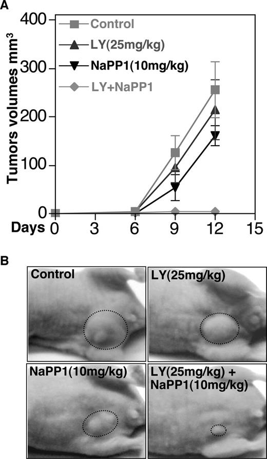 Fig. 5. NaPP1 and LY294002 show combinatorial efficacy on growth of 3T3:v-erbB-as1 tumor allografts. A, 3T3:v-erbB-as1 cells transduced with v-erbB-as1 (1 × 106) were injected s.c. in BALB/c nu/nu mice and allowed to establish (from 6–10 mm3 in size) for 7 days. The animals were then treated once daily (starting on day 0 of the graph shown) with i.p. injection of DMSO (control), 25 mg/kg LY, 10 mg/kg NaPP1, or 25 mg/kg LY plus 10 mg/kg NaPP1. Each data point represents the mean tumor volume ± SE obtained from six mice. B, representative animals after treatment indicated. Circles indicate tumor.