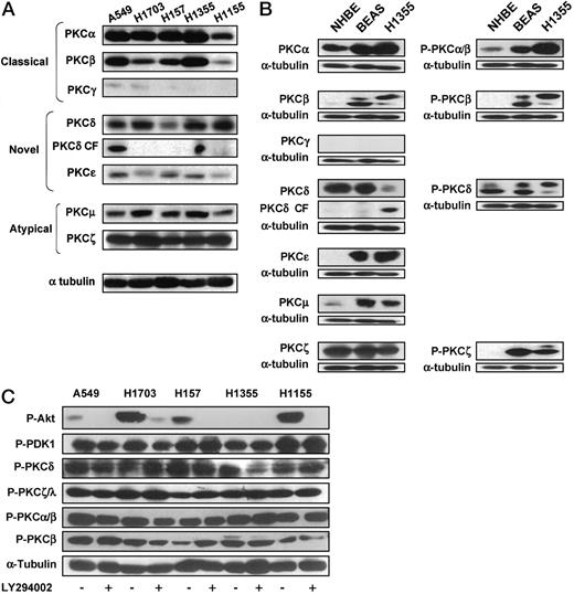Fig. 1. Analysis of PKC isoforms. A, expression of PKC isoforms in NSCLC cells. Isoform-specific antibodies were used in immunoblotting experiments as described. The CF of PKCδ (PKCδ CF) was detected with the PKCδ-specific antibody. α-Tubulin is shown as a loading control. B, comparison of PKC expression and phosphorylation in normal lung epithelial cells (NHBE), immortalized lung epithelial cells (BEAS-2B), and a lung cancer cell line (H1355). Immunoblotting with isoform-specific antibodies is shown in the left column. Immunoblotting with phospho-specific PKC isoform antibodies is shown in the right column. α-Tubulin is shown as a loading control. C, maintenance of PKC phosphorylation with serum starvation is PI3K independent. NSCLC cells were serum starved in the absence or presence of LY294002 (25 μm). Immunoblotting with phospho-specific PKC, PDK-1, Akt, and α-tubulin antibodies was performed as described. All figures are representative of three or more independent experiments.
