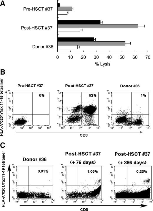 Fig. 4. Selective expansion of Tax11-19-specific CTL in peripheral blood mononuclear cell (PBMC) cultures from patient #37 after hematopoietic stem cell transplantation (HSCT). A, PBMCs from pre-HSCT patient #37 at 40 days of culture which were stimulated with formalin-fixed ILT-#37 cells two times, and those from post-HSCT patient #37 and donor #36 at day 41 after three stimulations were examined for cytotoxicity against ILT-#37 (▪), TCL-Kan ( ), and LCL-Kan (□) cells at an E:T ratio of 30. Values represent the mean of triplicate assays. B, flow cytometric analysis of HLA-A*0201/Tax11-19 tetramer-binding CD8+ T cells in the indicated PBMC cultures stimulated with ILT-#37. The PBMC cultures from post-HSCT patient #37 (middle) and donor #36 (right) were used at day 46 of culture, whereas those from pre-HSCT patient #37 (left) were used at day 36 because they failed to grow long term. Tetramer specificity was confirmed by staining a human T-cell leukemia virus type I Tax11-19-specific cell line, Tc-Myj (Ref. 21; data not shown). Numbers in top right corners indicate percentages of PBMCs bound to the tetramer. A total of 100,000 events was collected in each case. C, kinetics of human T-cell leukemia virus type I Tax 11-19-specific CD8+ cells in uncultured PBMCs in post-HSCT patient #37. Uncultured cryopreserved PBMCs isolated from donor #36 (left) or from post-HSCT patient #37 at +76 days (middle) and +386 days (right) after HSCT were stained with phycoerythrin-conjugated HLA-A*0201/Tax 11-19 tetramer. The percentages of CD8+ and HLA-A*0201/Tax 1--19 tetramer+ cells in the PBMCs are indicated in the top right quadrants.
