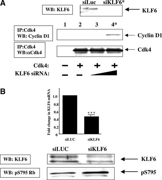 Fig. 4. Silencing of endogenous KLF6 by small interference RNA (siRNA) restores binding of endogenous cyclin D1 to cdk4 and reverses suppression by KLF6 of retinoblastoma (Rb) phosphorylation at Ser795. A, top, a 19-nucleotide sequence of siRNA against KLF6 was cloned into the pSUPER plasmid (see “Materials and Methods”). The resulting pSUPER-KLF6 plasmid (siKLF6) was transfected into HCT116 cells and the pSUPER vector expressing an irrelevant protein, pSUPER-Luciferase (siLUC), was used as a control. Shown is an immunoblot of endogenous KLF6 protein levels in the presence or absence of transfected siKLF6 plasmid. Bottom, HCT116 cells were transfected with empty vector or cyclin-dependent kinase (cdk) 4 in the presence or absence of siKLF6. Twenty-four h after transfection, cells were harvested, and cdk4 was immunoprecipitated from whole cell extracts. An immunoblot of ectopically expressed cdk4 and endogenous cyclin D1 is shown. Silencing of KLF6 expression by siRNA (at the highest concentration denoted by an asterisk) increased detectable endogenous cyclin D1 binding to cdk4 as demonstrated by appearance of endogenous cyclin D1 that coimmunoprecipitates (co-IP) with cdk4 (Lane 4). B, siKLF6 was transfected into PC3 cells expressing markedly reduced endogenous KLF6 protein levels as shown in the KLF6 immunoblot. Silencing of endogenous KLF6 mRNA is confirmed by real-time quantitative PCR (see “Materials and Methods”). An immunoblot of pRb S795 shows that siKLF6 expression reverses suppression of Rb phosphorylation at Ser795 by KLF6 upon its targeted gene silencing. All data in this figure were derived from the same extracts and were reproducible in separate experiments.