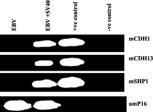 Fig. 4. Promoter methylation profile in EBV and EBV+SV40-infected PBMC. PBMC were infected with EBV or EBV+SV40 as described in “Materials and Methods.” MSP assays for 10 TSGs was performed as described in “Materials and Methods” (also see Fig. 1<$REFLINK>). The unmethylated form of p16 was run as an internal control for bisulfite treatment. The data show methylation of CDH1, CDH13, and SHP1 in EBV+SV40-infected group but none in only EBV alone-infected group.