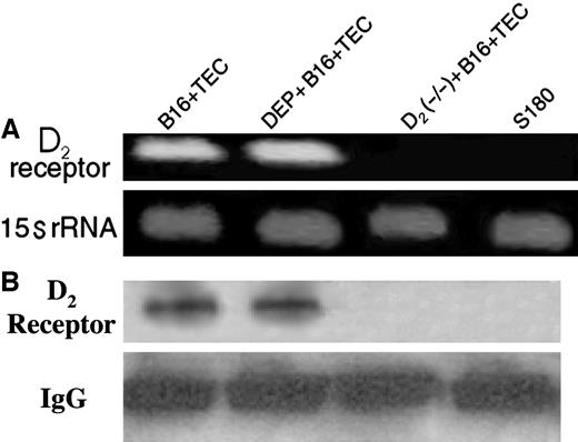 Fig. 2. Expression of D2 receptor in endothelium. In A, semiquantitative reverse transciption-PCR shows D2 class of dopamine receptor mRNA in tumor endothelial cells (TEC) isolated from B16 melanoma. D2 receptor mRNA (D2 receptor) is present in TECs collected from both intact (N+B16) and ablated peripheral dopaminergic nerve (Dep+B16) wild-type control, but D2 receptor mRNA is absent in TEC isolated from B16 melanoma-bearing D2 receptor knockout mice (D2 (−/−)+B16) and negative control sarcoma 180 (S180) tumor. 15s rRNA, control. Results are representatives of six separate experiments. In B, immunoprecipitation followed by immunoblot shows Mr ∼85,000 D2 dopamine receptor in extracts of TEC isolated from both intact (N+B16) and ablated peripheral dopaminergic nerve (Dep+B16) but absent in TEC isolated from D2 receptor knock out mice (D2 (−/−) + B16) and negative control S180 tumor. The figure is representative of six separate experiments.