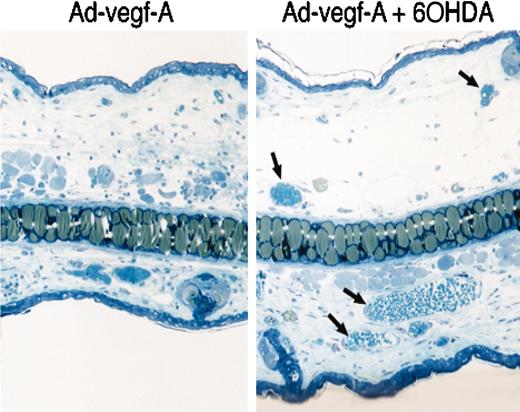 Fig. 3. Microscopic appearance of angiogenesis in the ears of athymic mice 2 days after local injection of 5 × 107 plaque-forming units of Ad-vegf (left, Ad-vegf-A). 6-hydroxydopamine-induced peripheral dopaminergic nerve-ablated mice [treatments with 6hydroxydopamine (6OHDA) for 2 days before virus injection, right panel]. Ears of 6OHDA-treated mice show striking angiogenesis as determined by naked eye, or by microscopy. Arrow, the mother vessels formation within 2 days. These are 50-μm section.