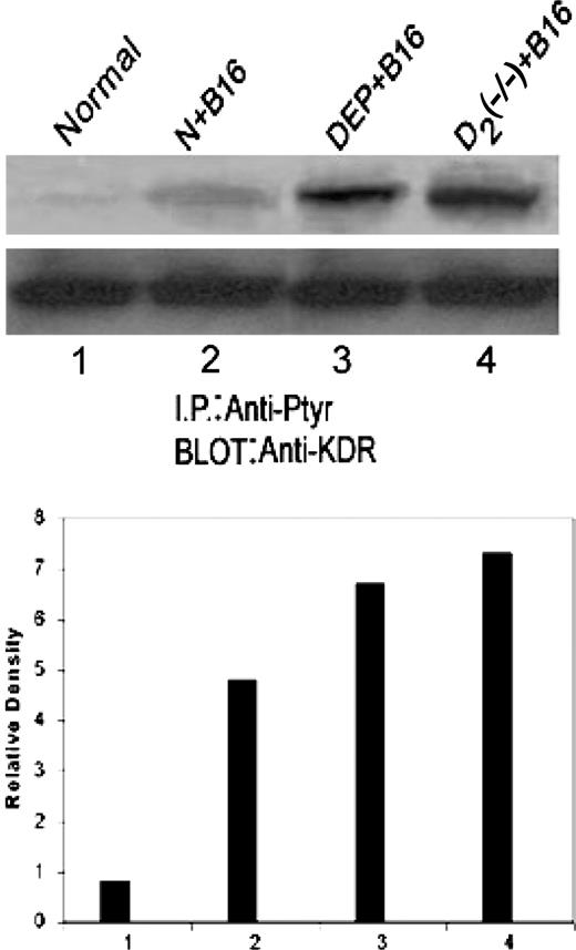 Fig. 4. Increased VPF/VEGF-induced phosphorylation in tumor endothelial cells (TECs) collected from the B16 melanoma-bearing mice with ablated peripheral dopaminergic nerves (Dep+B16) or dopamine D2 receptor knockout mice [D2 (−/−)+B16] when compared with B16-bearing mice with intact peripheral dopaminergic nerves (N+B16). Results are representative of six separate experiments. (I.P.:Anti-Ptyr, Anti-Phosphotyrosine; BLOT: Anti-KDR, anti-VEGFR-2.)