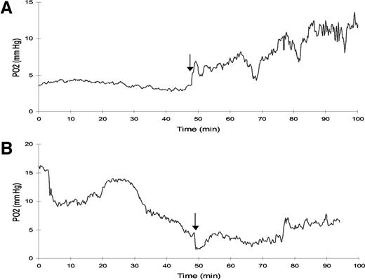 Fig. 3. Examples of temporal pO2 traces for FSA (A) and 9L (B); arrow, the time at which the rat was switched from air to oxygen breathing. For FSA, pO2 increased with the onset of O2 breathing. The 9L tumor trace shows an immediate slight decrease in pO2 when O2 breathing began, but the level then returned to the baseline pO2 a few minutes later.