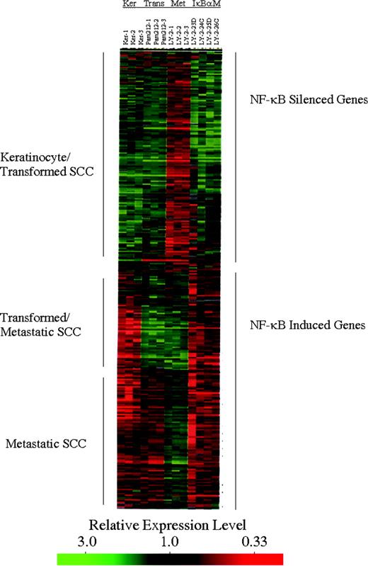 Fig. 2. Cluster analysis of genes related to tumor progression and NF-κB in SCC. Complementary DNA was prepared from mRNA from three independent preparations of keratinocytes, Pam 212, and Pam LY-2 cells and four Pam LY-2 clones expressing IκBαM after culture with DOX for 72 hours. A total of 308 of 15,000 cDNA microarray elements exhibited mean signal differences of ≥2-fold (99% confidence interval) for triplicate comparisons between cDNAs from normal keratinocytes (Ker), transformed Pam 212 (Trans), and/or metastatic Pam LY-2 (Met) cells. Three dominant patterns were detected that clustered according to the stepwise differences in phenotype among KER, Pam 212, and Pam LY-2 cells. Cluster 1 genes showed similar profiles in keratinocytes and transformed Pam 212 cells (green) but reduced expression in metastatic LY-2 cells (red). Cluster 2 genes showed lower expression in normal cells (red) but increased expression in transformed and metastatic cells (green). Cluster 3 genes showed low intensity in keratinocytes and transformed cells (red) and increased signal intensity primarily in LY-2 metastatic cells (green).