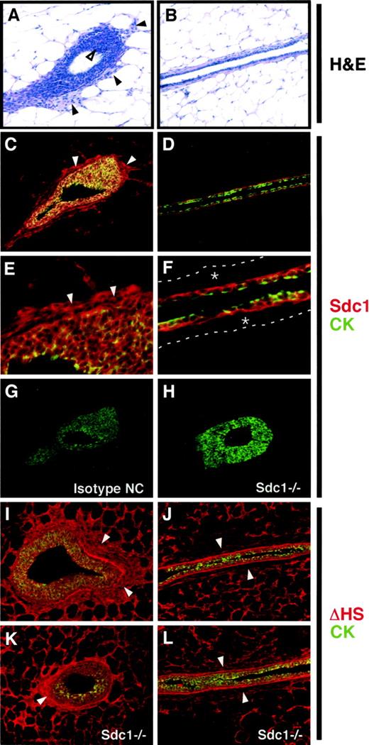 Induction of Syndecan-1 Expression in Stromal Fibroblasts Promotes ...
