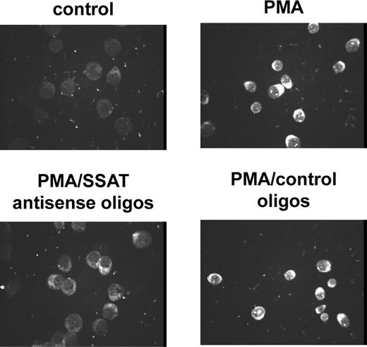 Fig. 4. Inhibition of PMA-induced SSAT expression by its antisense oligonucleotides (oligos); SSAT expression was determined by immunostaining with a specific antibody. Immunostaining was performed after 8 hours of treatment of HL-60 cells with 3 nmol/L PMA in the presence of either SSAT antisense oligos or a mixture of oligos of random sequence, which served as the control. After treatment, the cells were fixed with methanol and reacted for 30 minutes with the primary antibodies at a 1:100 dilution and then with the secondary antibodies at a 1:200 dilution in the presence of 1 μg/mL propidium iodide. The fluorescent intensity of propidium iodide was used as a reference.