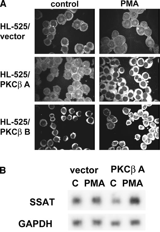 Fig. 5. PMA-induced SSAT expression in HL-525 cells transfected with a PKC-β expression vector determined by immunostaining with SSAT antibodies (A) and expression of corresponding gene determined by Northern blotting (B). The HL-525 cells were either transfected with a PKC-β cDNA neo gene expression vector (HL-525/PKC-β) or with an expression vector containing only the neo gene (HL-525/vector). HL-525 cells were treated with 30 nmol/L PMA for 8 hours. The immunostaining with the specific antibody was as described in the legend to Fig. 3<$REFLINK>. For Northern blotting, RNA was hybridized first to the SSAT probe and then to the GAPDH probe.