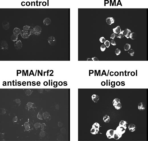Fig. 7. Inhibition of PMA-induced Nrf2 expression in HL-60 cells by its antisense oligonucleotides (oligos) determined by immunostaining with specific antibodies. Nrf2 expression was assessed by immunostaining with Nrf2 antibodies. The cells were treated for 4 hours with 3 nmol/L PMA in the presence or absence of Nrf2 antisense oligos or a mixture of oligos of random sequence, which served as a control. After treatment, the cells were fixed with formaldehyde and permeabilized with Triton X-100 as described in Materials and Methods. The primary and secondary antibodies were incubated with the cells for 1 hour at a 1:200 and 1:400 dilution, respectively.
