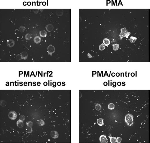 Fig. 8. Inhibition of PMA-induced SSAT expression in HL-60 cells by Nrf2 antisense oligonucleotides (oligos). SSAT expression was assessed by immunostaining with SSAT antibodies. The cells were treated for 8 hours with 3 nmol/L PMA in the presence or absence of Nrf2 antisense oligos or a mixture of oligos of random sequence, which served as a control. After treatment, the cells were fixed with methanol as described in Materials and Methods. The primary and secondary antibodies were incubated with the cells for 30 minutes after 1:100 and 1:200 dilutions, respectively.