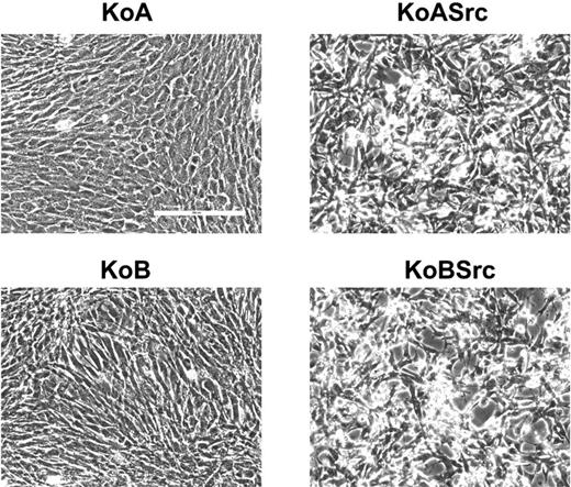 Fig. 1. Morphology of nontransformed and Src-transformed cells. Phase-contrast images of KoA and KoB cells before and after Src transformation are shown as indicated. Src-transformed cells assumed a typically transformed morphology compared with nontransformed cells. Bar = 200 μm.