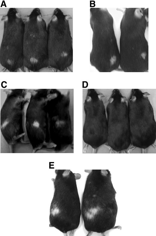 Fig. 2. Intradermal immunization with adenovirus encoding human tyrosinase-related protein 2 (AdhTrp-2) is associated with the development of vitiligo, and CD4+ and CD8+ T cells can mediate such autoimmune destruction. C57BL/6 mice (A–D) were immunized intradermally (i.d.) with 108 AdhTrp-2, and on day 7 postimmunization, groups B, C, and D began to receive i.p. injections (once a week) of anti-CD4 (B) or anti-CD8 (C) monoclonal antibodies, or both (D). E, an example of B cell-deficient mice that developed vitiligo comparable with C57BL/6 wild-type mice following i.d. immunization with AdhTrp-2. Photographs were taken 8 weeks after immunization, and they are representative of multiple mice in each group from more than three experiments.
